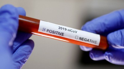 CORONAVIRUS - Así es el TEST para detectarlo