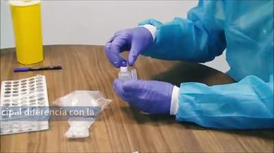 This is how the rapid test to detect Coronavirus in 10 minutes works