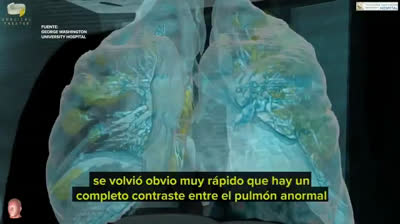 Cómo afecta el Coronavirus a tus pulmones