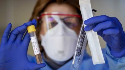 Sanidad revela que fueron 50.000 los test defectuosos comprados en China