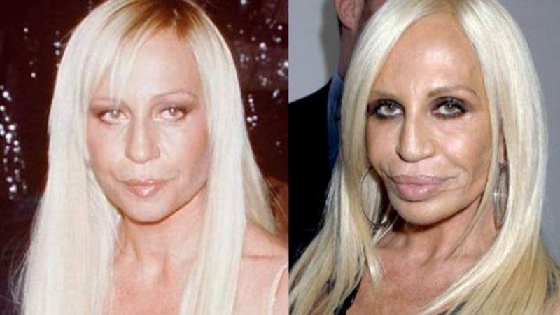 La transformación estética de Donatella Versace - TokyVideo