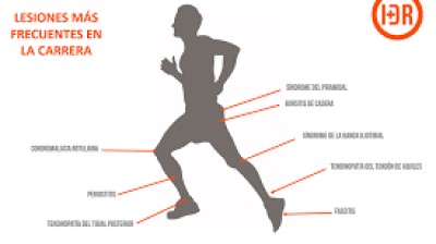 Trucos para evitar lesiones en el running