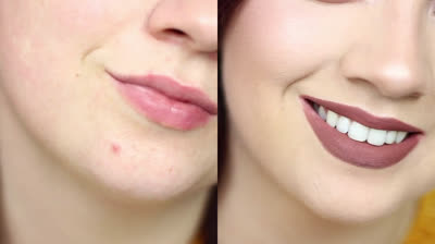 Trucos para cubrir las imperfecciones