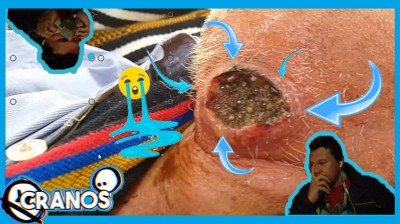 LOS GRANOS Y BARROS MAS ASQUEROSOS