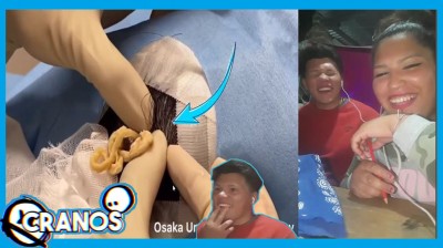 LOS GRANOS Y BARROS MAS ASQUEROSOS (PARTE 2)